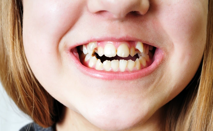 χαρακτηριστικά-που-κληρονομούμε-μόνο-από-τον-μπαμπά- χαρακτηριστικά-που-κληρονομούμε-μόνο-από-τον-μπαμπά-