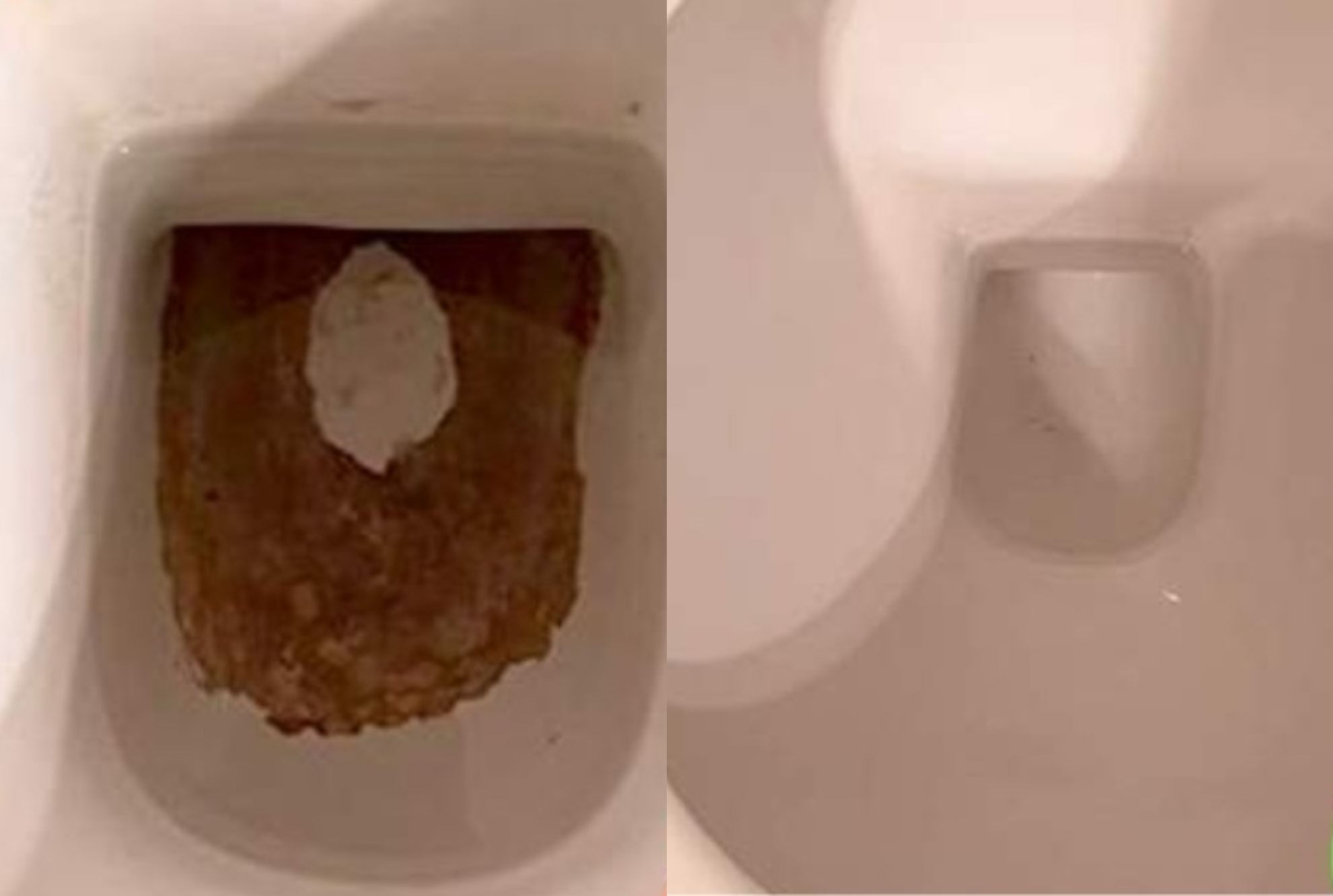 Πουρί μαυρίλες και καφέ σημάδια στον πάτο της τουαλέτας: