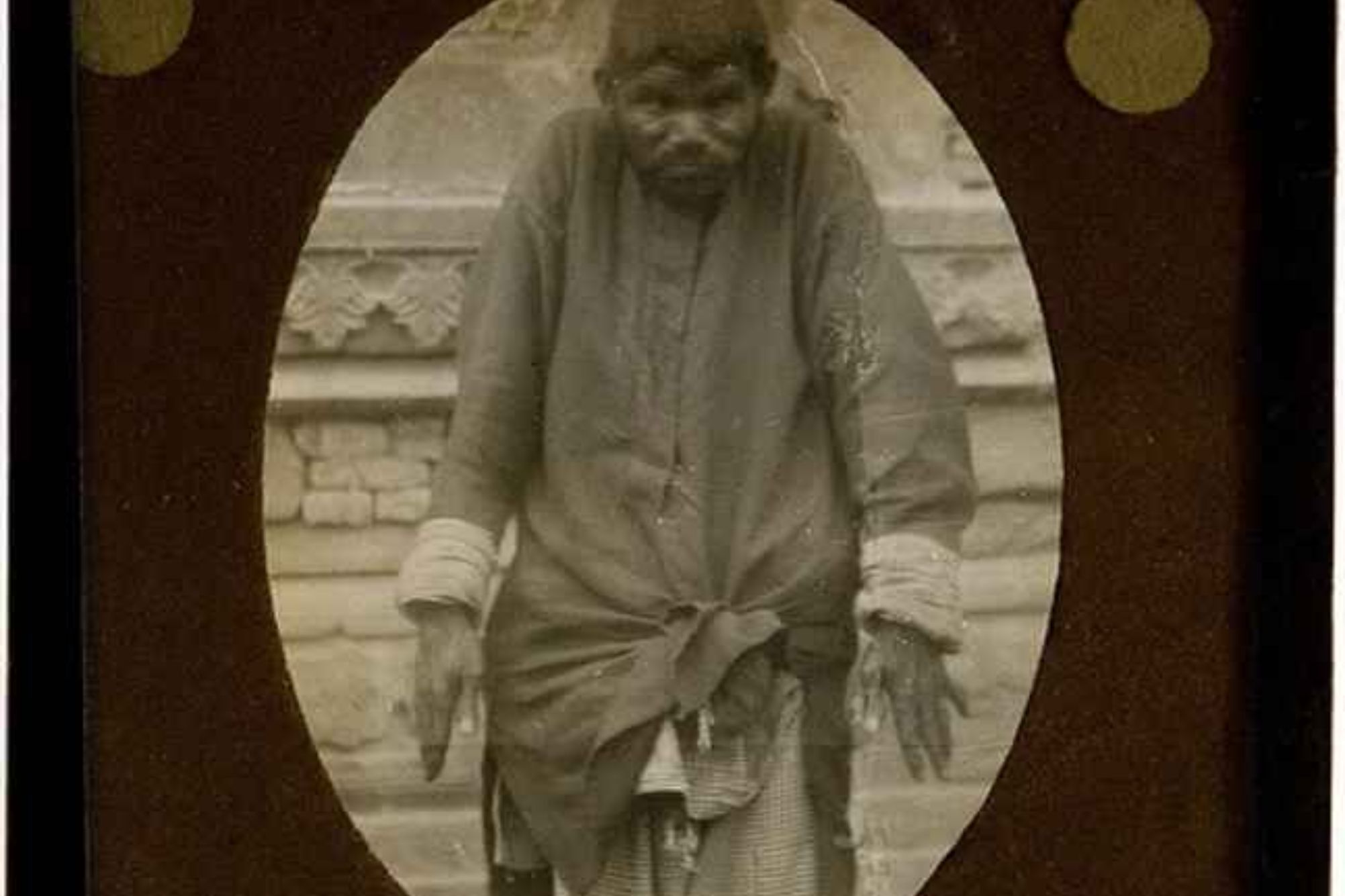 Απίστευτες ιστορίες παιδιών που εγκαταλείφθηκαν και μεγάλωσαν με ζώα