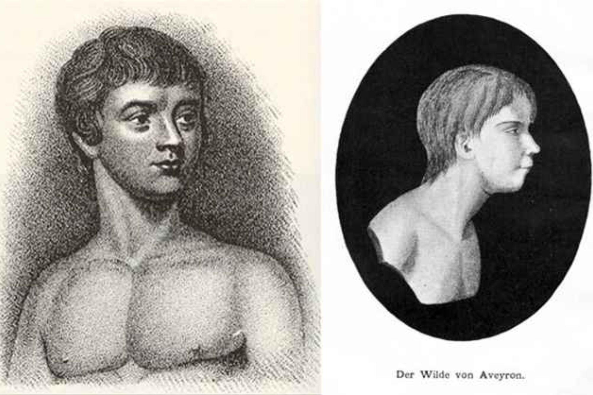 Απίστευτες ιστορίες παιδιών που εγκαταλείφθηκαν και μεγάλωσαν με ζώα