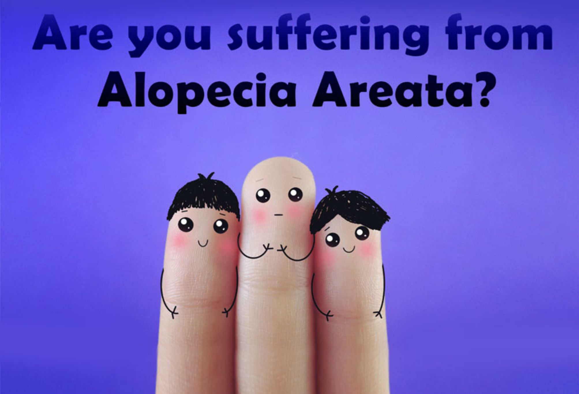 Γυροειδής αλωπεκία ή τριχοφάγος: Τι είναι ποια είναι τα αίτια τα συμπτώματα και η θεραπεία