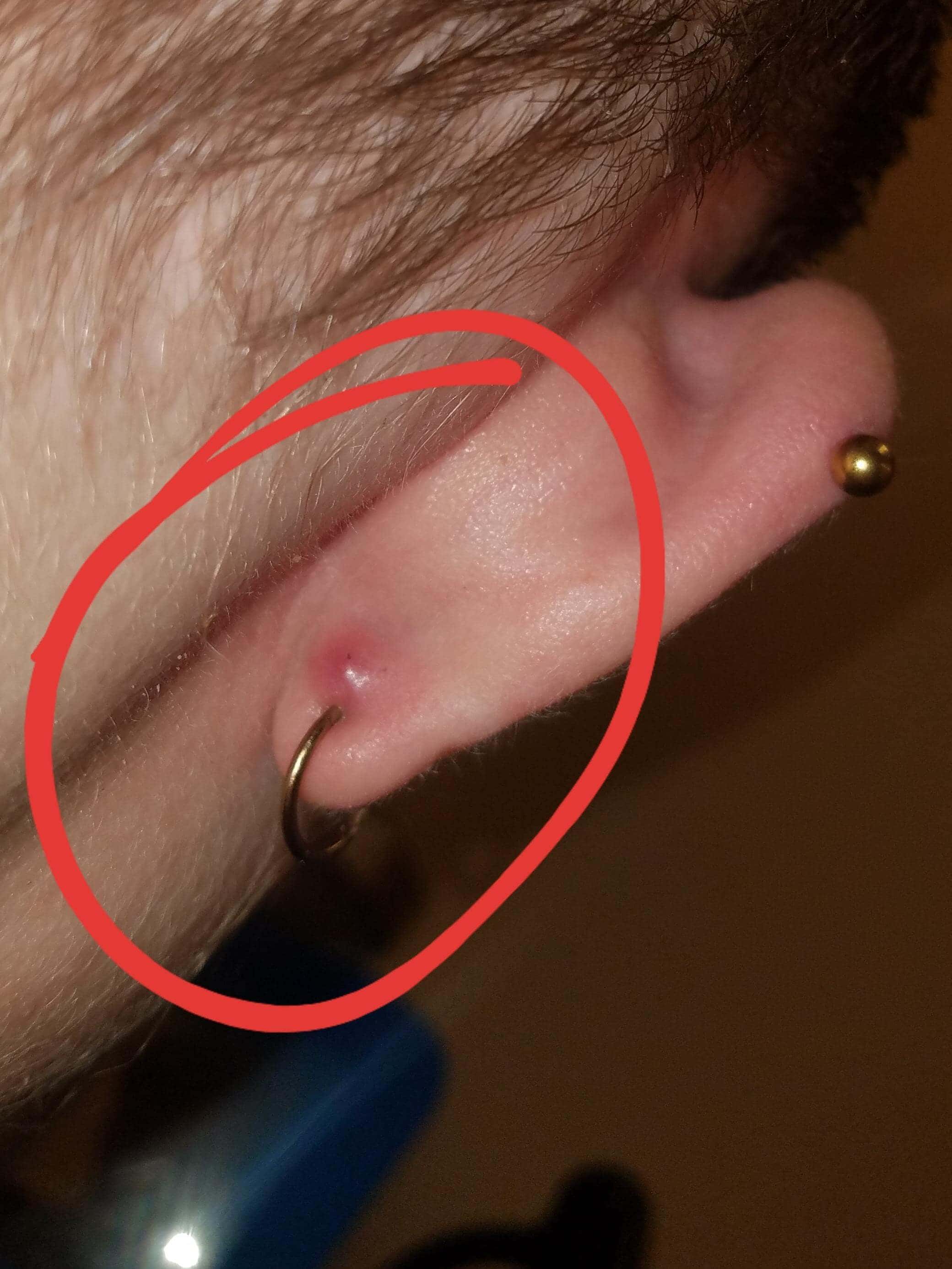 Piercing-στην εφηβεία-Σκουλαρίκι-σε μύτη-αυτιά-γλώσσα-κίνδυνοι-επιπλοκές-