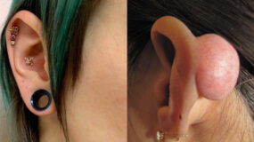 Piercing-στην εφηβεία-Σκουλαρίκι-σε μύτη-αυτιά-γλώσσα-κίνδυνοι-επιπλοκές-