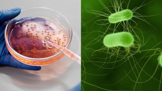Ε.coli : Εντοπίστηκε νέο στέλεχος άκρως μολυσματικό και «υπερανθεκτικό»