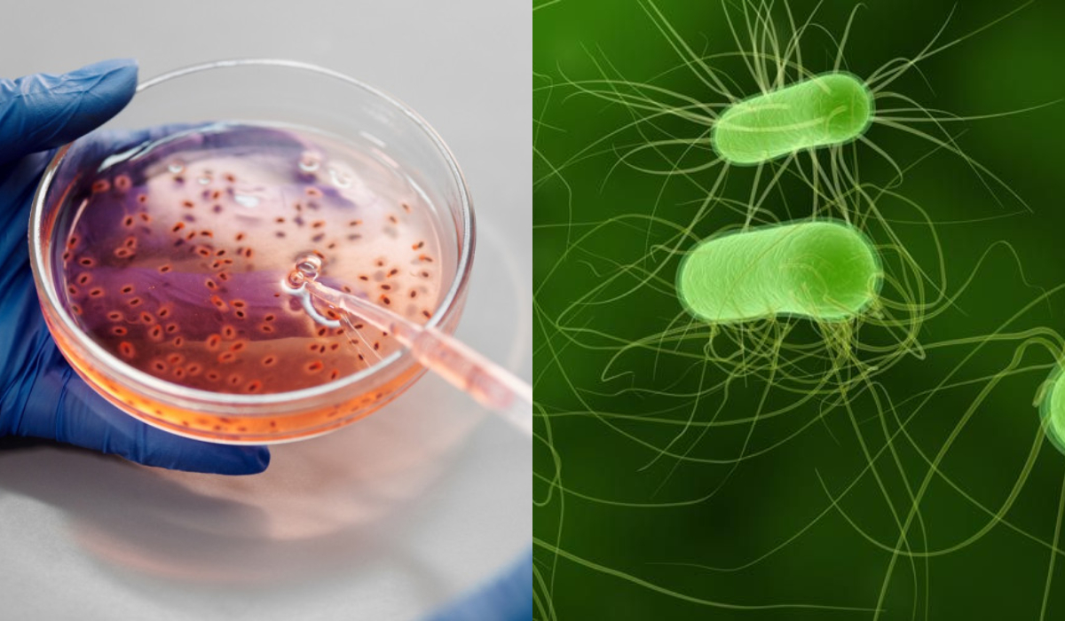 Ε.coli : Εντοπίστηκε νέο στέλεχος άκρως μολυσματικό και «υπερανθεκτικό»