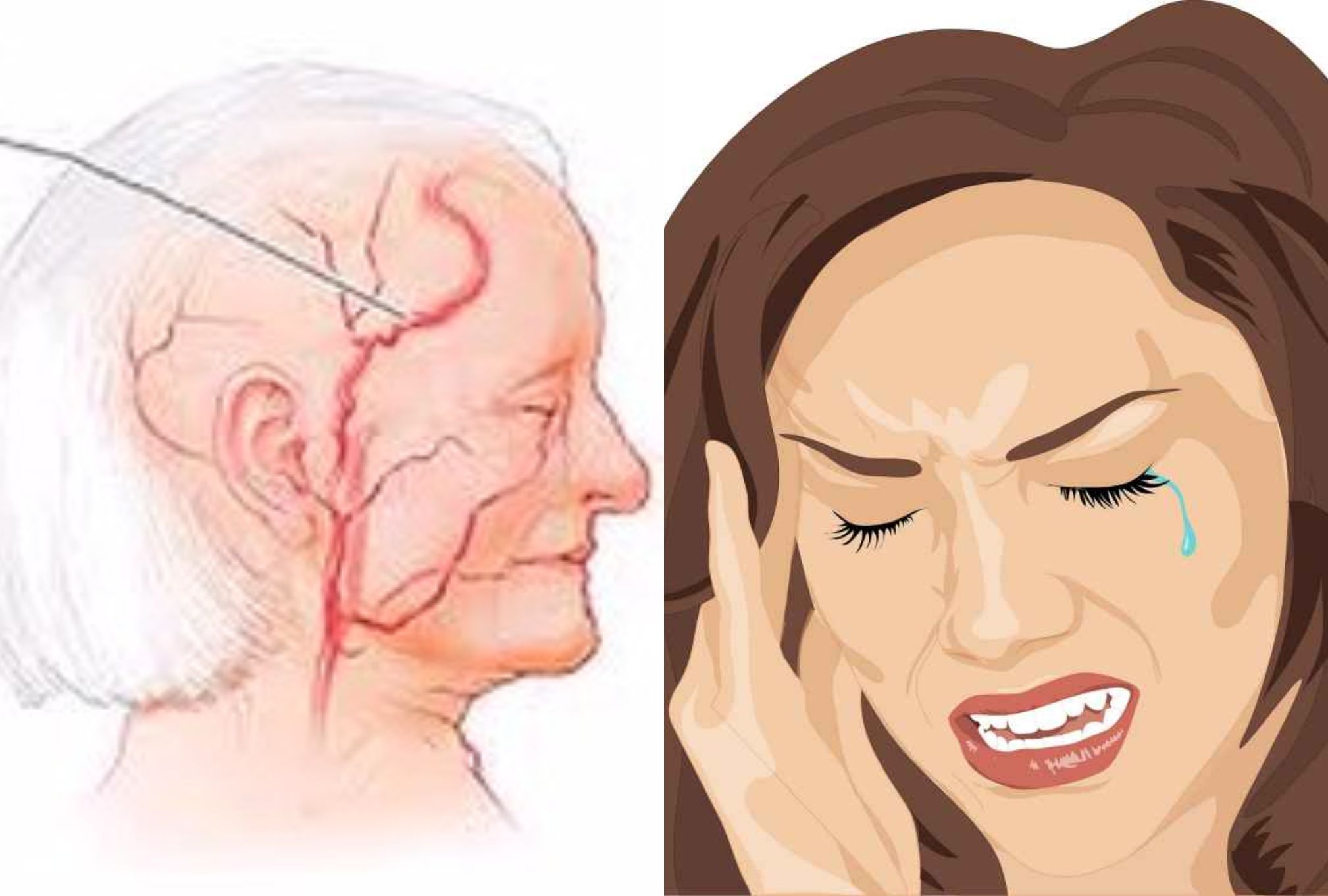 Γιγαντοκυτταρική αρτηρίτιδα: Τι είναι ποια τα συμπτώματα και ποια η θεραπεία