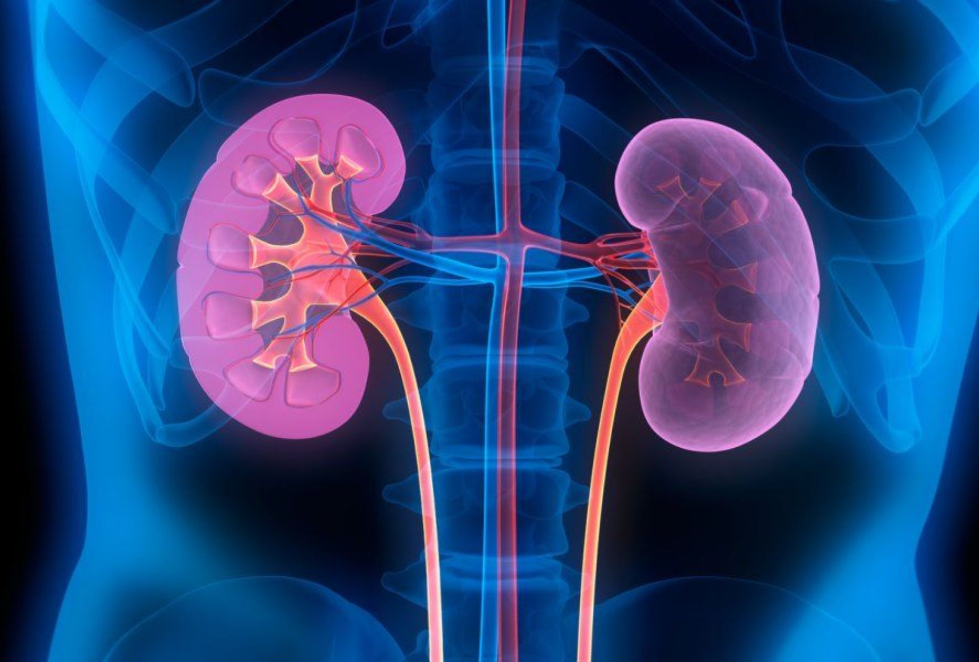 Αυτόματο προσχέδιο