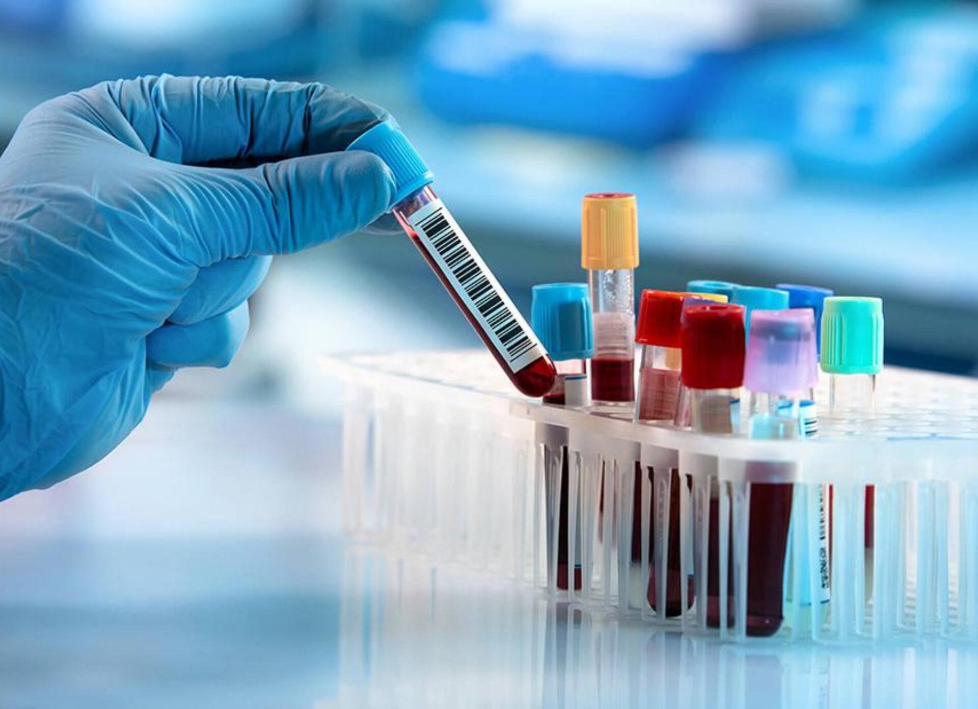 Αιμορροφιλία: Τι είναι ποια τα συμπτώματα και πως αντιμετωπίζεται