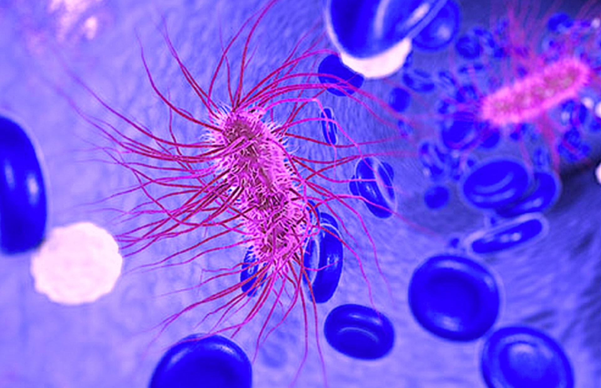 Αλλαντίαση: Τι μπορεί να την προκαλέσει και ποια τα συμπτώματα