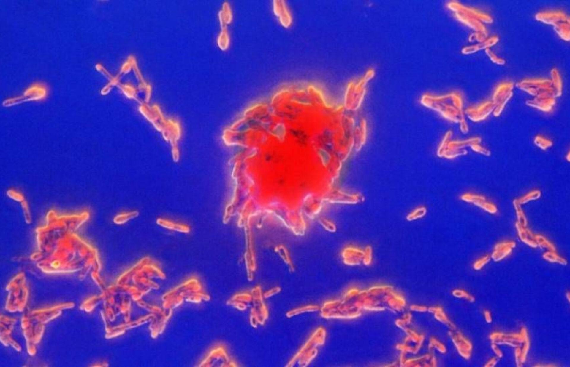 Αλλαντίαση: Τι μπορεί να την προκαλέσει και ποια τα συμπτώματα