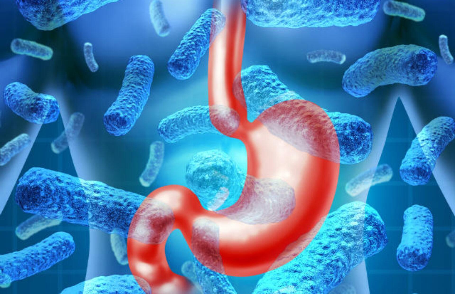 Αλλαντίαση: Τι μπορεί να την προκαλέσει και ποια τα συμπτώματα