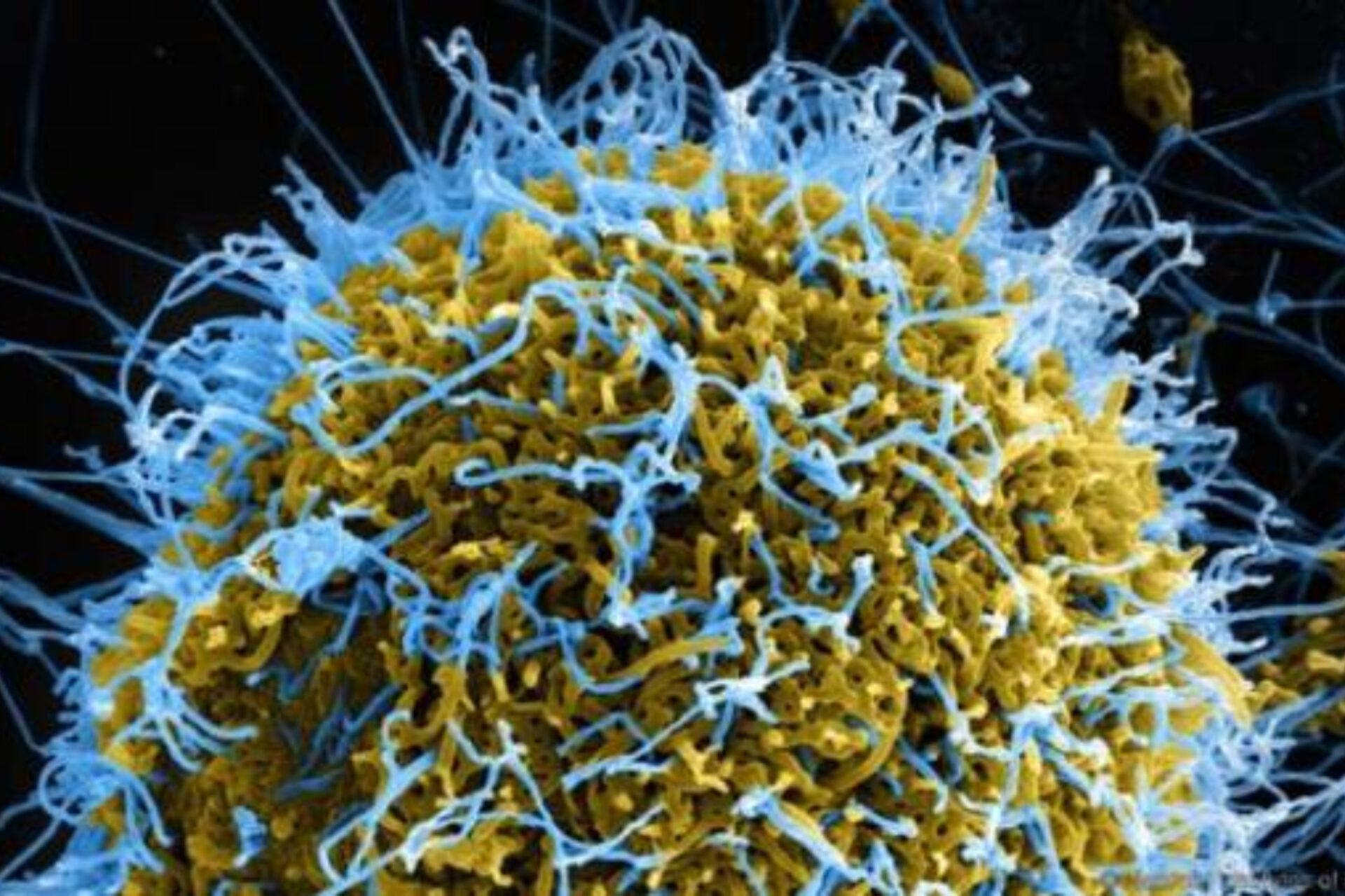 Γονοκκοκική λοίμωξη ή γονόρροια: Πώς μεταδίδεται τι συμπτώματα έχει και ποια η θεραπεία