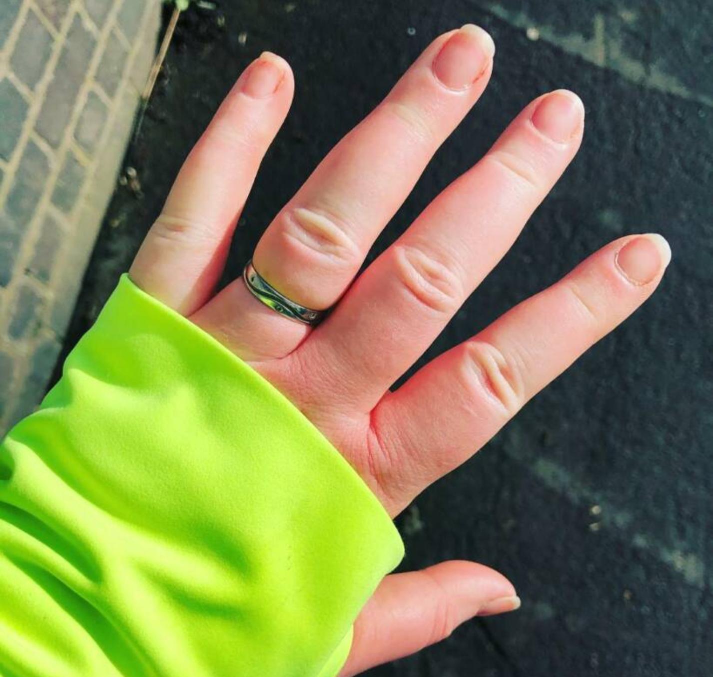 10 Συμπτώματα στο σώμα μας που μαρτυρούν πως ο καιρός επηρεάζει την υγεία μας