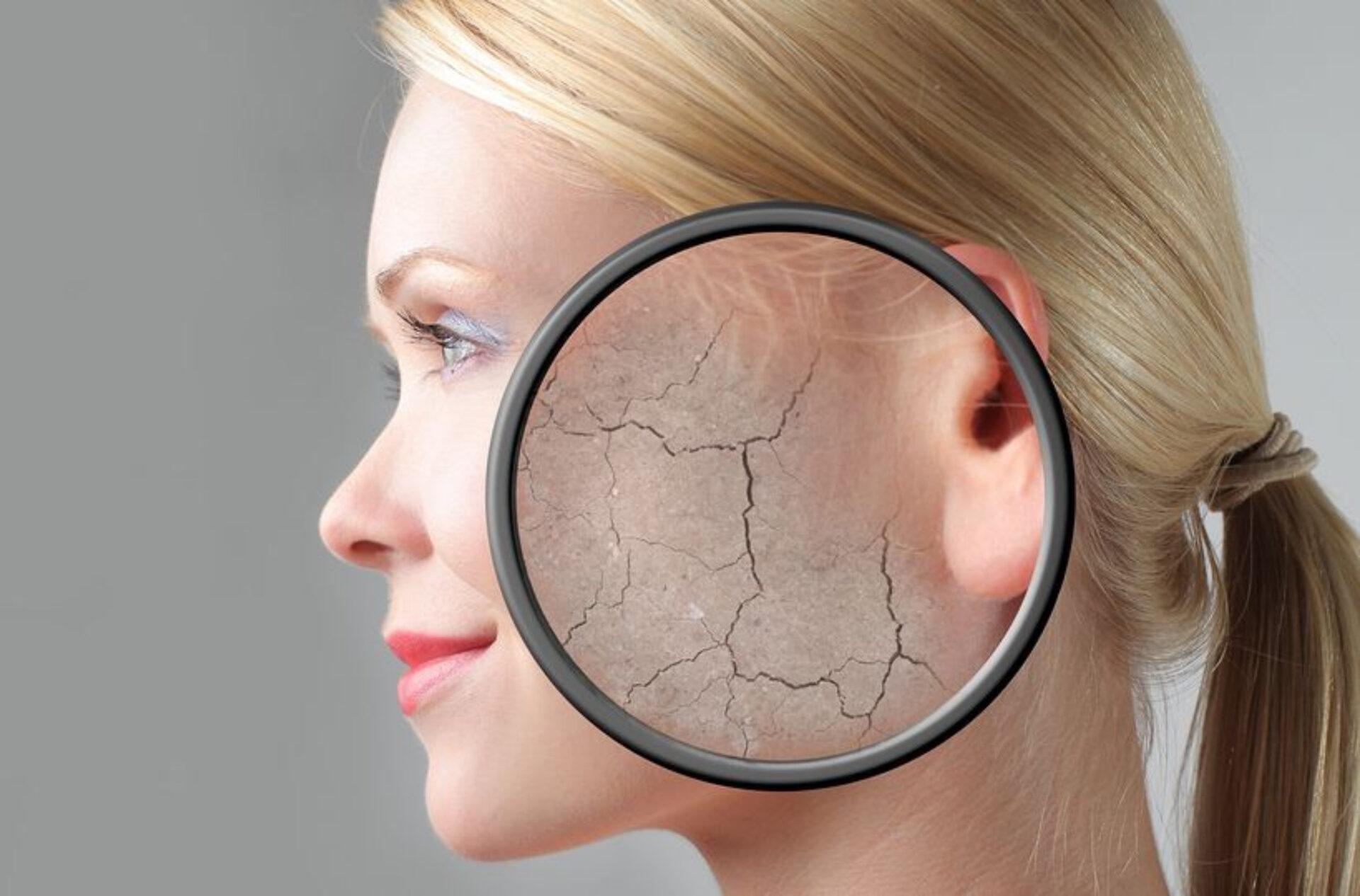 10 Συμπτώματα στο σώμα μας που μαρτυρούν πως ο καιρός επηρεάζει την υγεία μας