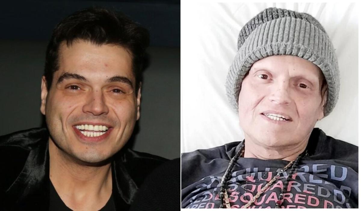 Γιώργος Δασκαλάκης : “Είχα πάθει ελεφαντίαση στα πόδια μου και ήταν πρησμένα, γι΄αυτό δεν περπατάω”