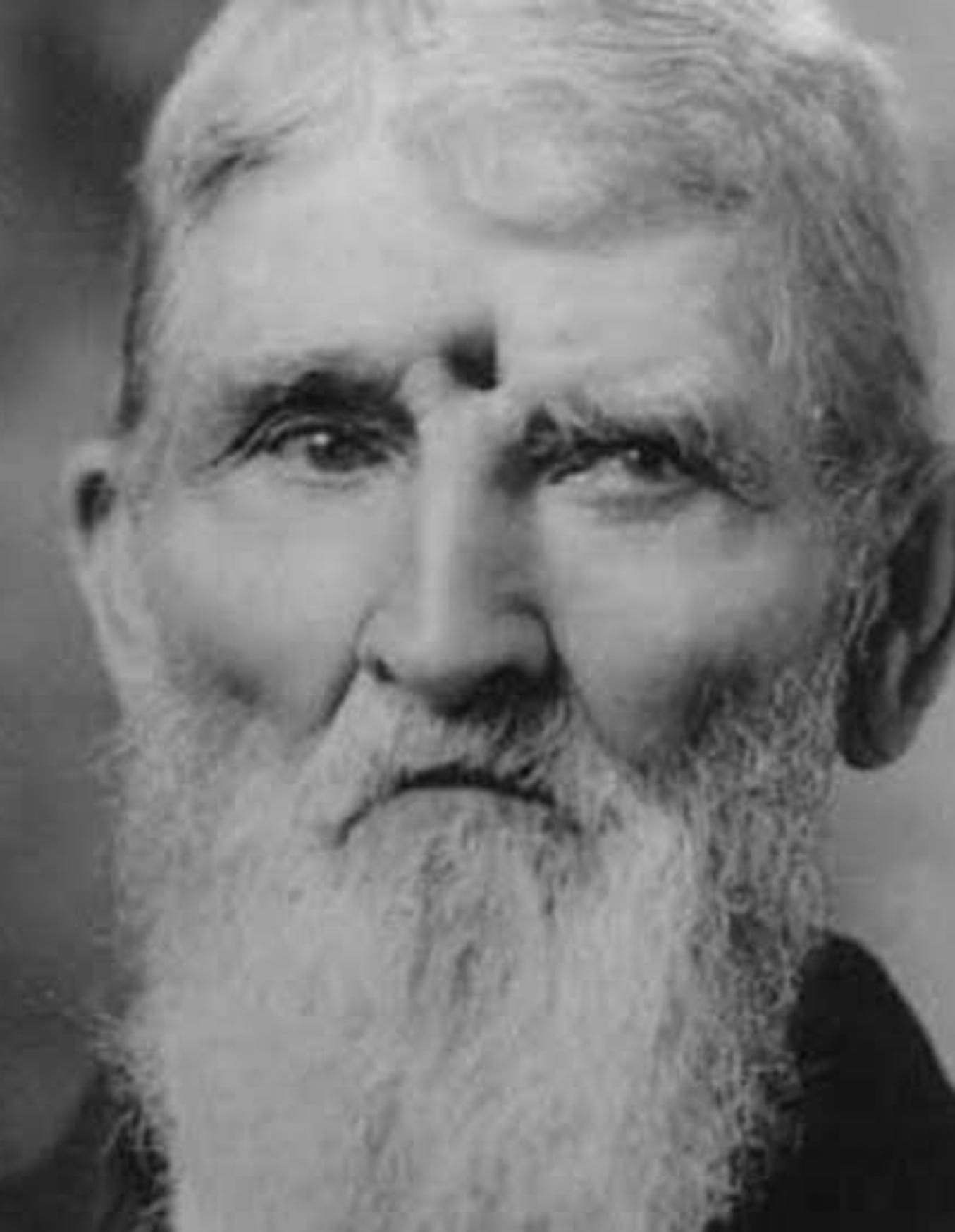 Jacob Miller: Η ιστορία του στρατιώτη που πυροβολήθηκε εξ’ επαφής και έζησε ως τα βαθιά γεράματα με μία τρύπα στο μέτωπο