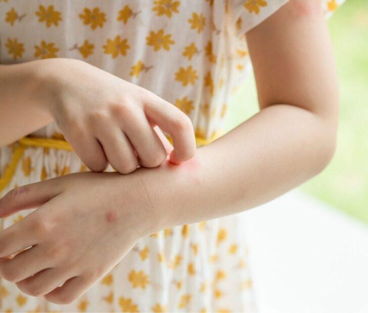 οι-πιο-συχνές-αλλεργίες-στα-παιδιά- οι-πιο-συχνές-αλλεργίες-στα-παιδιά-