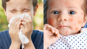 οι-πιο-συχνές-αλλεργίες-στα-παιδιά-