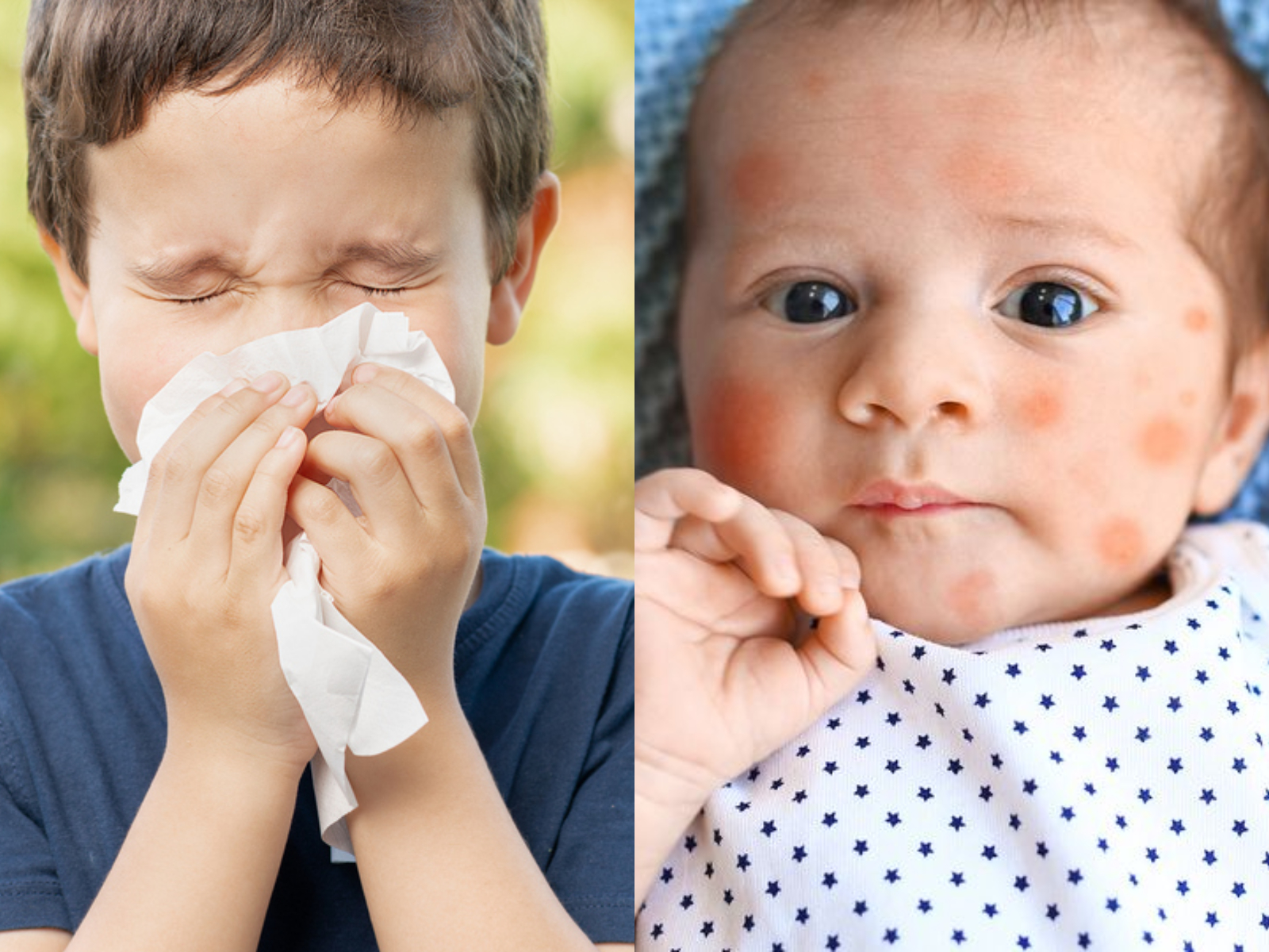 οι-πιο-συχνές-αλλεργίες-στα-παιδιά-