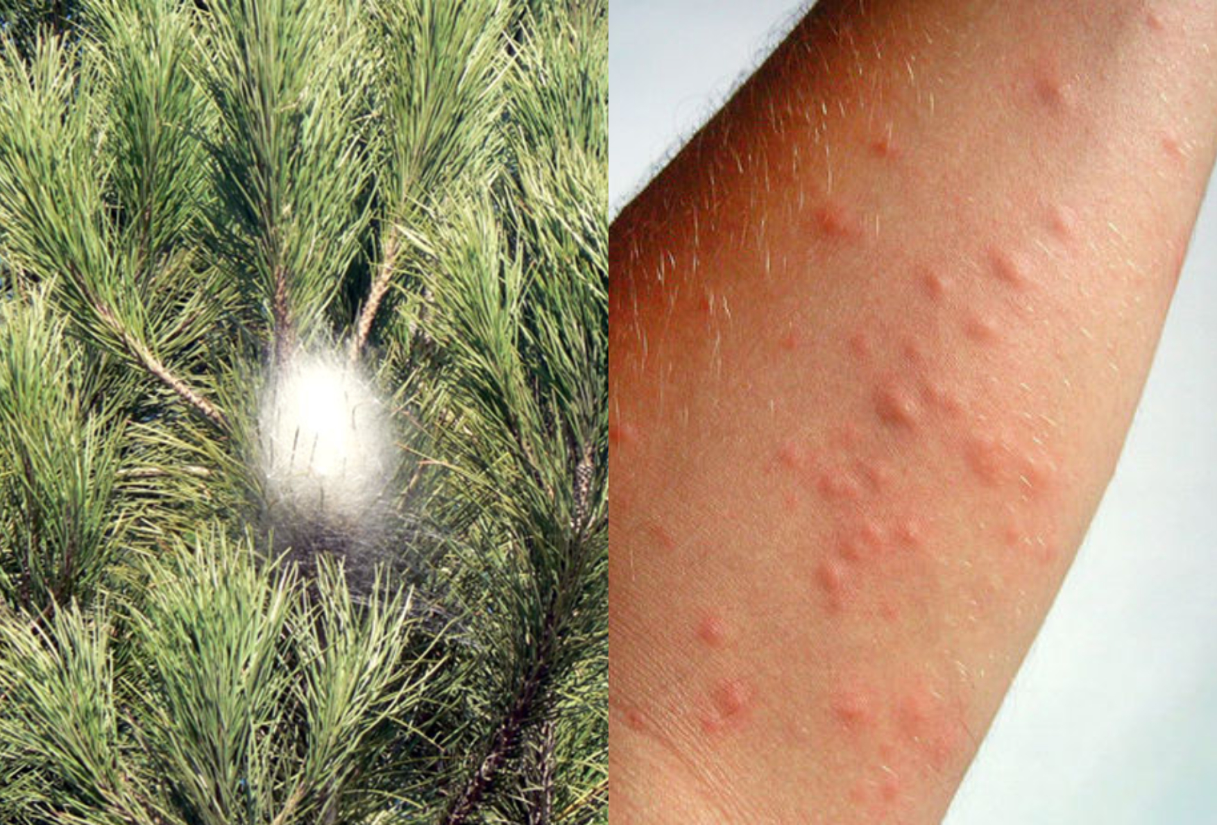Αλλεργία στη γύρη των πεύκων: Ποια τα συμπτώματα και ποια τα μέτρα προφύλαξης