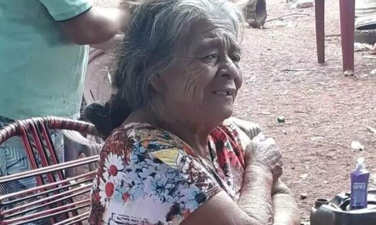 Πίστευαν πως είχε καρκίνο και κυοφορούσε πέτρινο παιδί