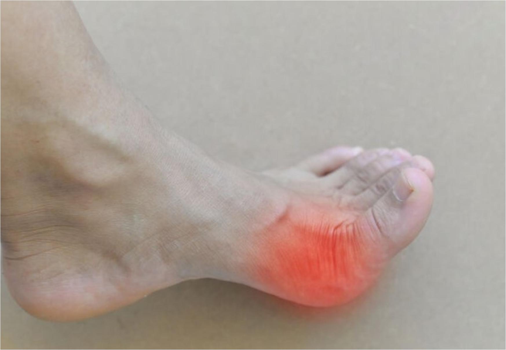 Η νόσος των βασιλιάδων: Τι είναι ποια τα συμπτώματα και ποια η θεραπεία