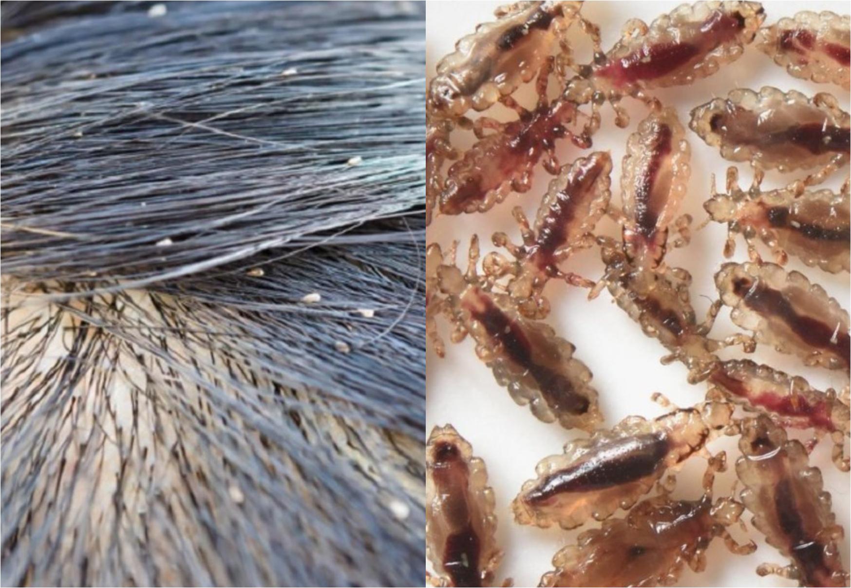 Ψείρες: Πώς να τις κρατήσετε μακριά από το κεφάλι των παιδιών σας