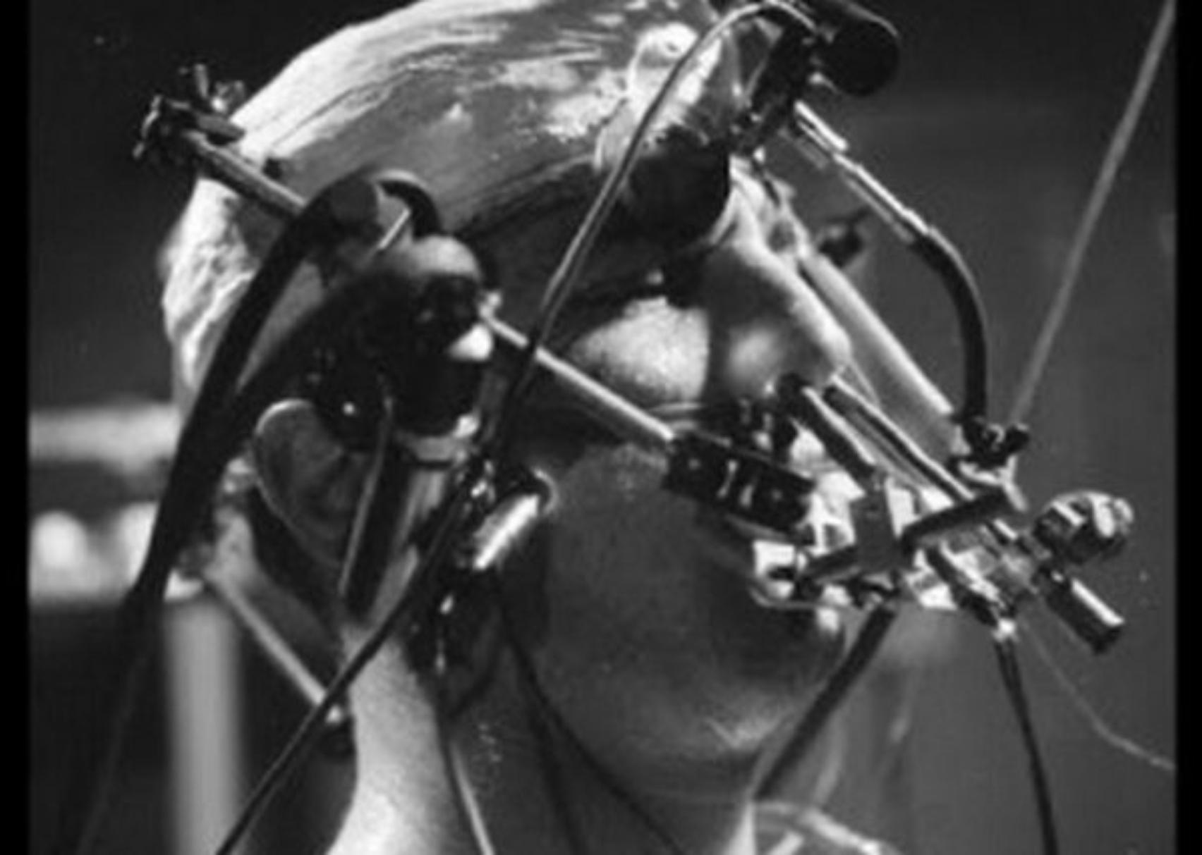 Project MK-ULTRA: Το πιο σκοτεινό πρόγραμμα που διενεργήθηκε ποτέ για τον έλεγχο του μυαλού