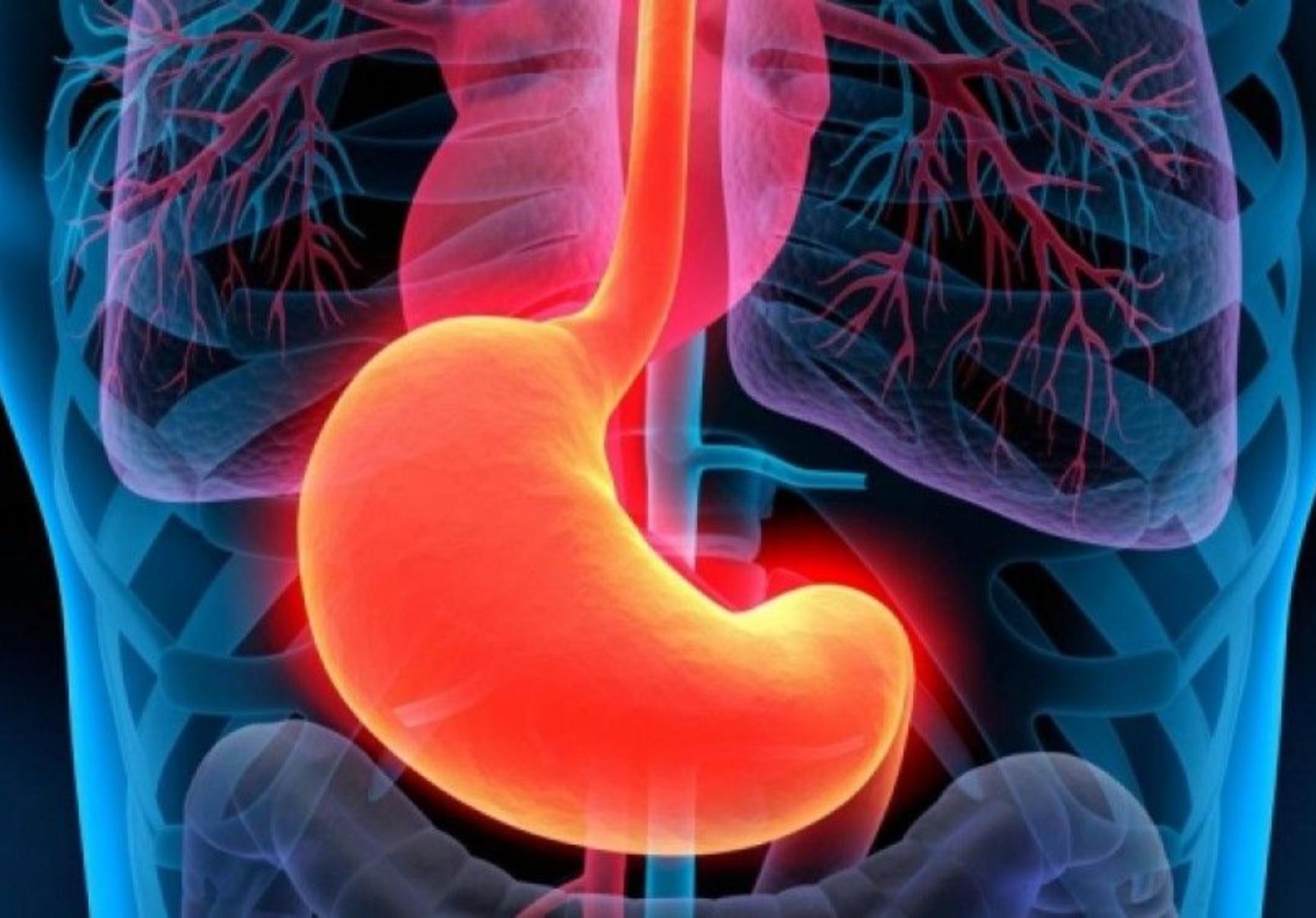 Πεπτικό έλκος: Τι είναι ποια τα συμπτώματα και πως αντιμετωπίζεται