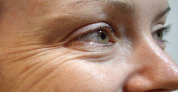 Σπιτική μάσκα ομορφιάς που εξαφανίζει τις ρυτίδες με ένα υλικό έκπληξη από τη φύση