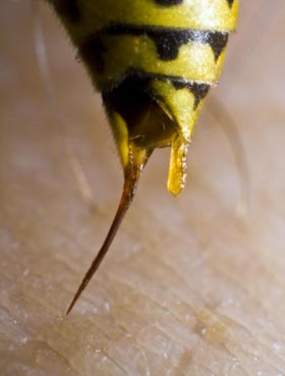 Τσίμπημα σφήκας: 10 Σπιτικοί Τρόποι για να το αντιμετωπίσετε και να ανακουφίσετε τον πόνο