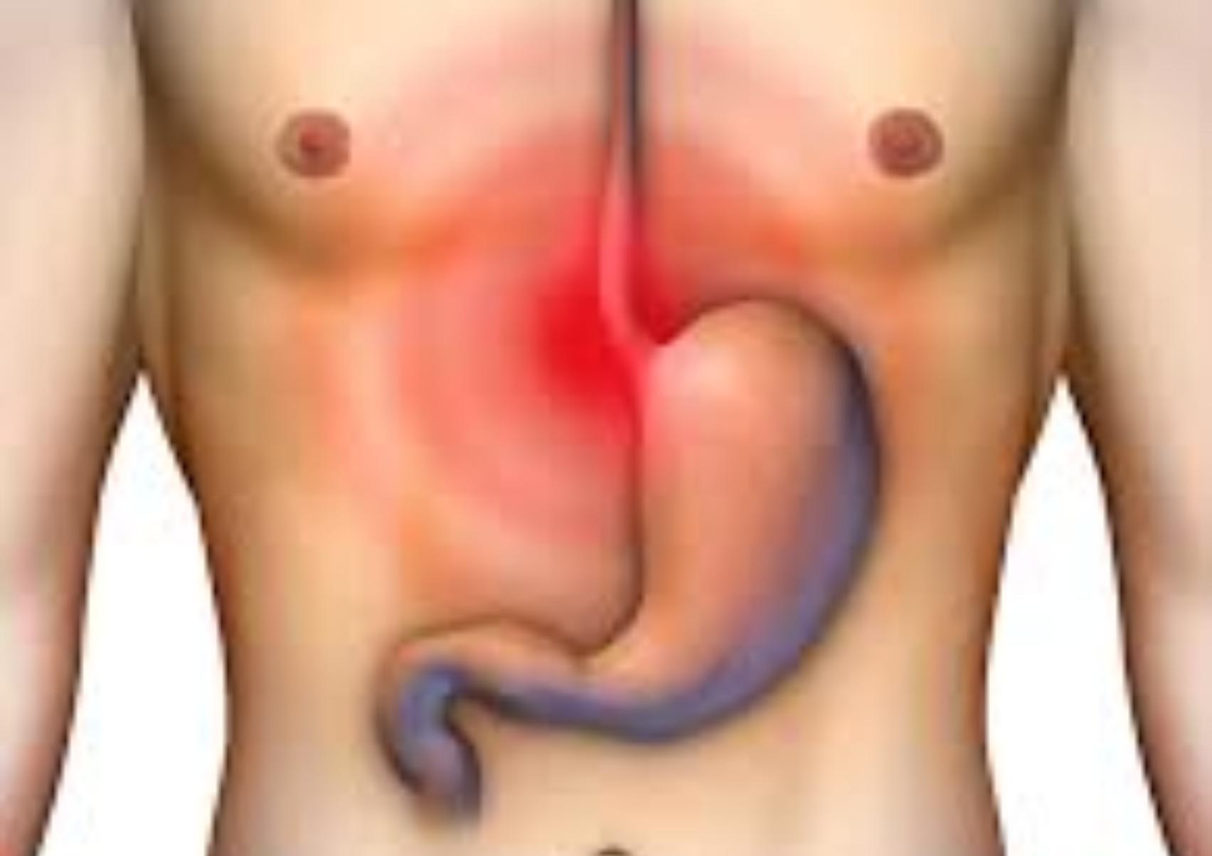 Βαρυστομαχιά και δυσπεψία απο την μαγειρίτσα το αρνί και τα αυγά: Δείτε πως να την αντιμετωπίσετε άμεσα