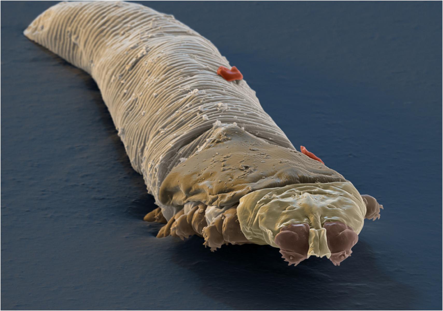 Demodex ή Δεμόδικας: Τα αόρατα αραχνοειδή ακάρεα που ζουν στο πρόσωπό μας και ποια προβλήματα υγείας προκαλούν
