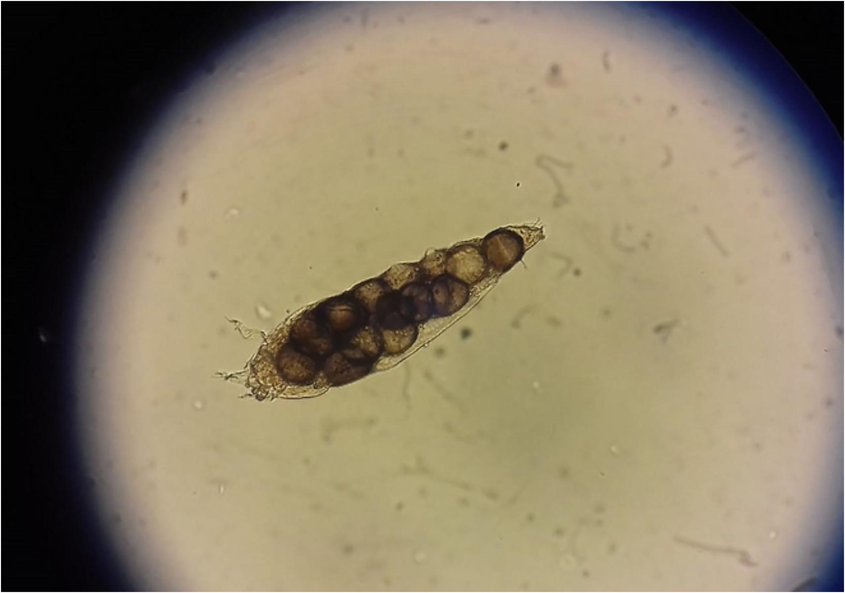 Demodex ή Δεμόδικας: Τα αόρατα αραχνοειδή ακάρεα που ζουν στο πρόσωπό μας και ποια προβλήματα υγείας προκαλούν