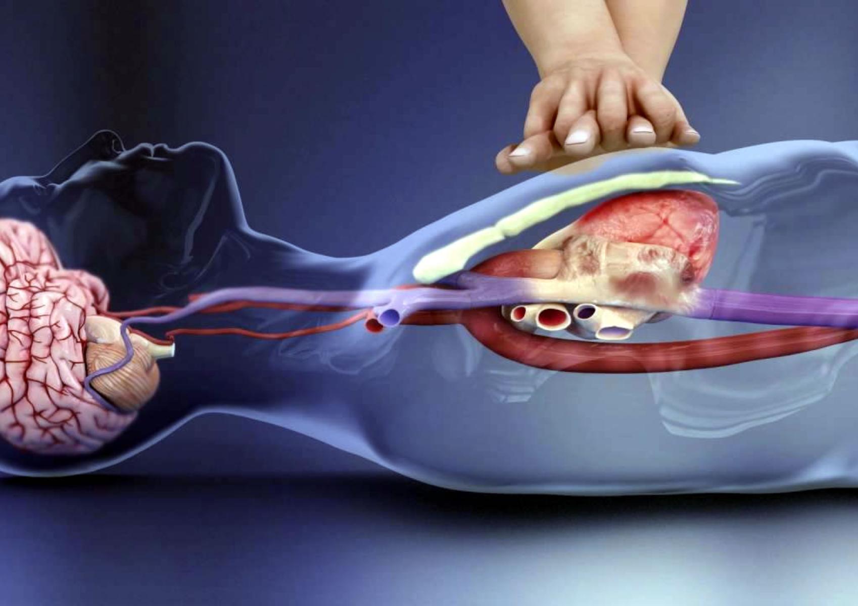 Αιφνίδια καρδιακή ανακοπή: Τι μπορεί να την προκαλέσει ποια τα συμπτώματα και πως να την αντιμετωπίσουμε δεν ειναι ετοιμο