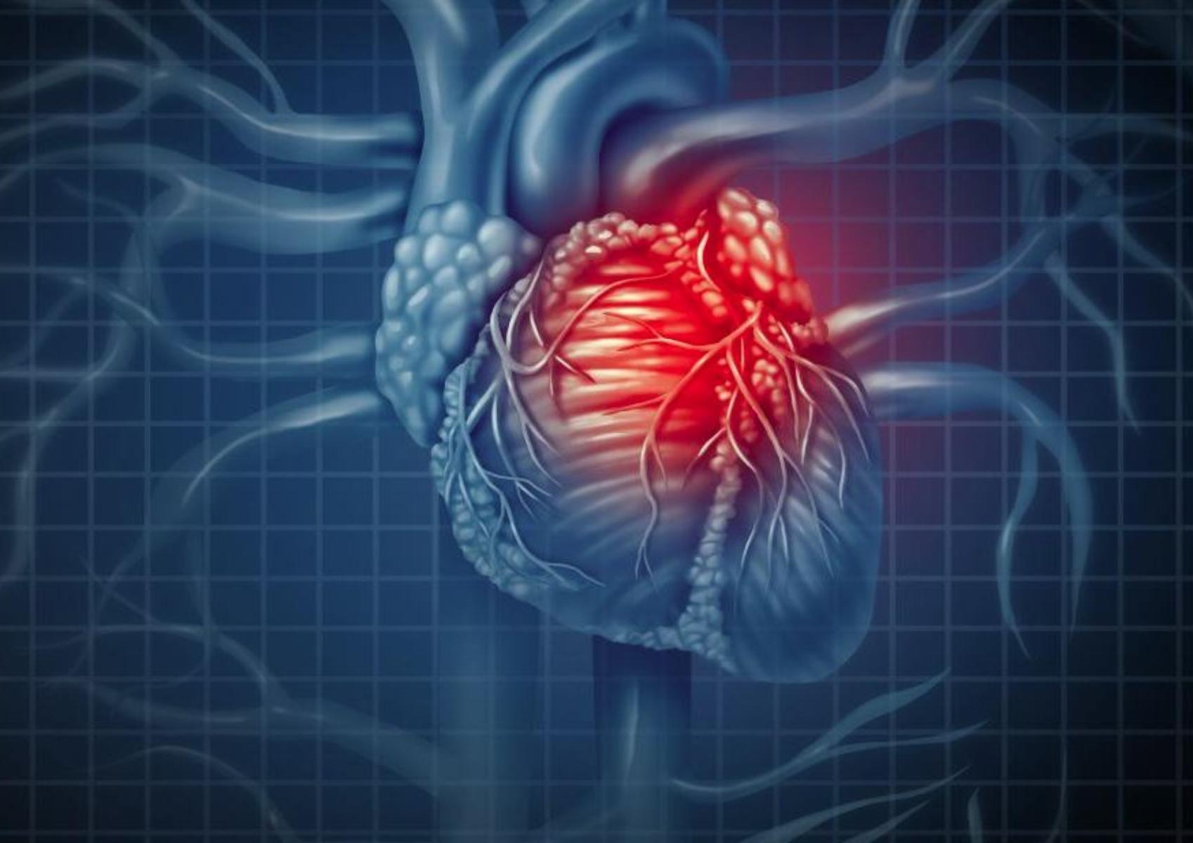 Αιφνίδια καρδιακή ανακοπή: Τι μπορεί να την προκαλέσει ποια τα συμπτώματα και πως να την αντιμετωπίσουμε δεν ειναι ετοιμο