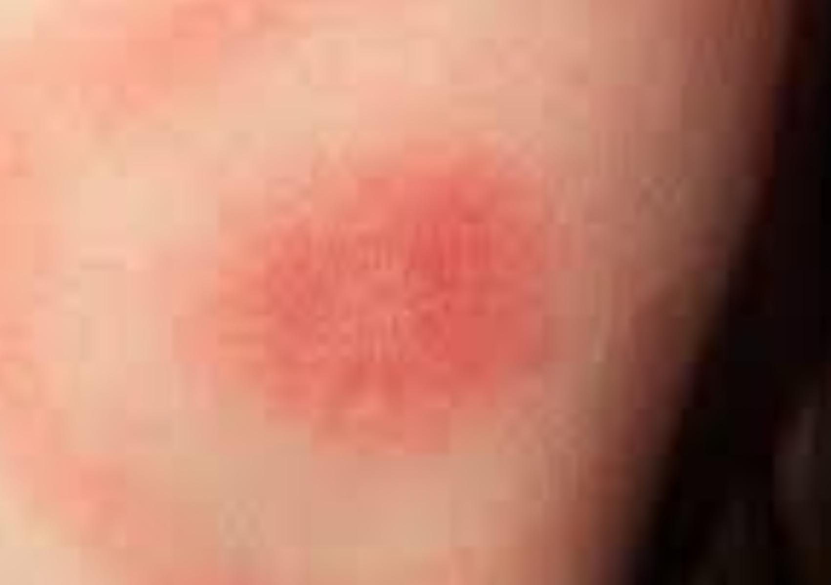 Σκνίπες: Οι αρρώστιες που μεταφέρουν και πως να τις διώξετε οριστικά από το σπίτι