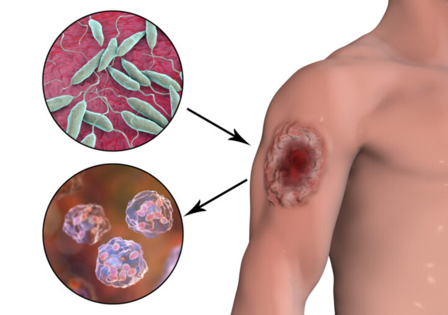 Μύγα της άμμου: Πως να τις αναγνωρίσετε τι προκαλεί το τσίμπημα της και πως να τις κρατήσετε μακριά