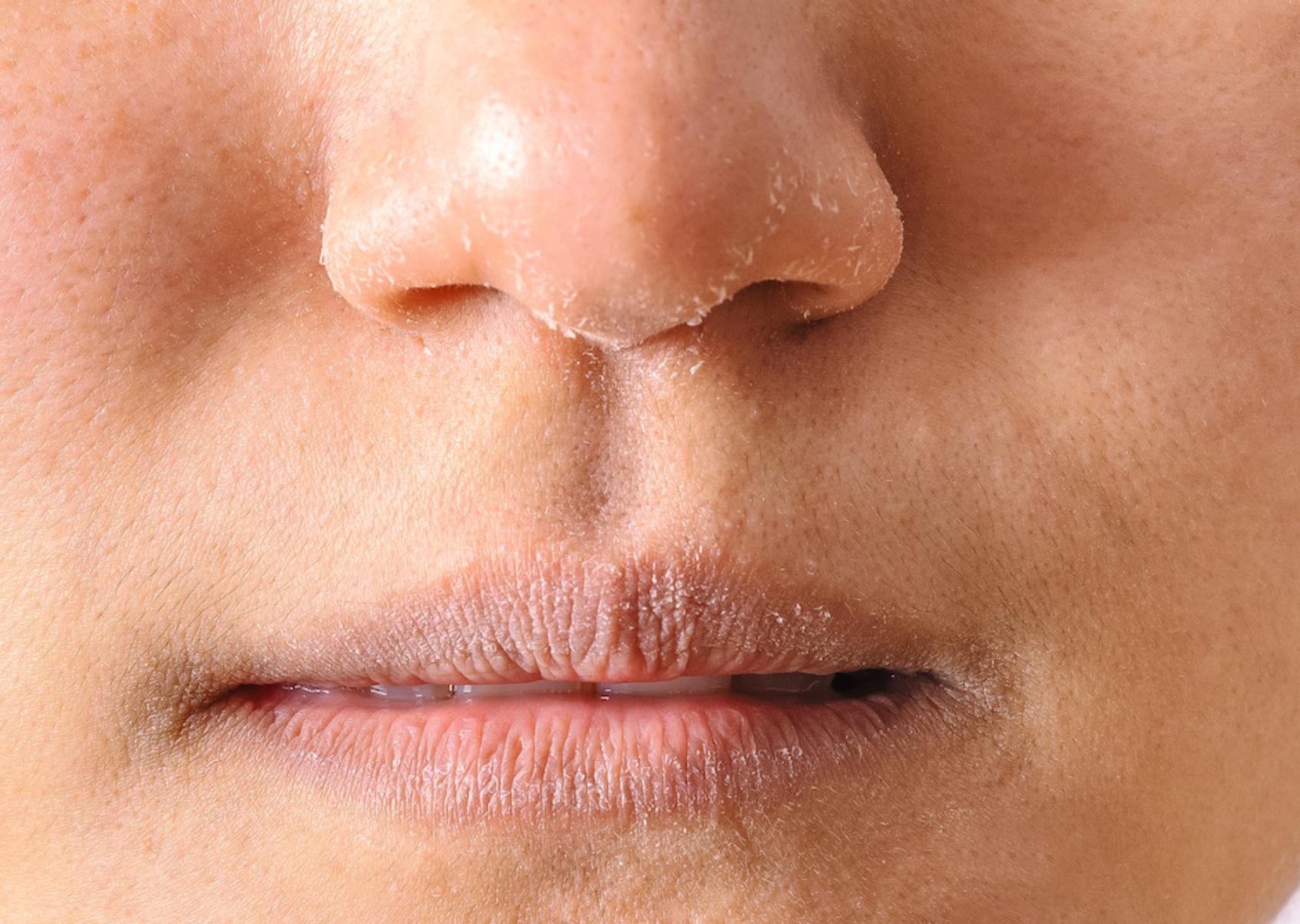 Αφυδάτωση το καλοκαίρι: Ποια τα αίτια τα συμπτώματα και πως να προστατεύουμε