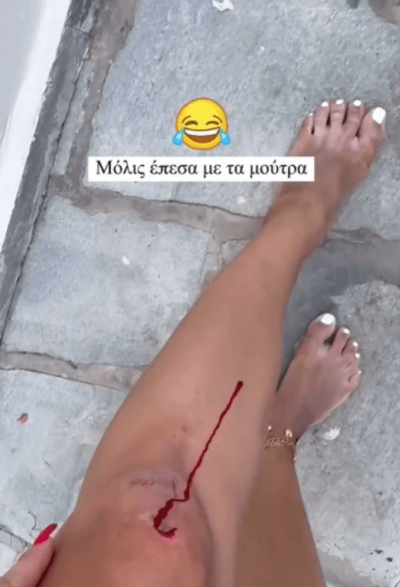 Ιωάννα Τούνη: Ατύχημα για την γνωστή influencer στην Σύρο