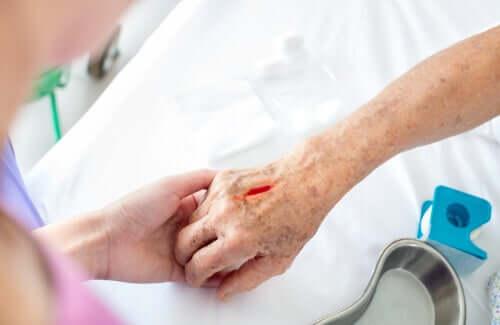 επικίνδυνα-δερματικά εξανθήματα-συμπτώματα-και-επιπλοκές- επικίνδυνα-δερματικά εξανθήματα-συμπτώματα-και-επιπλοκές-