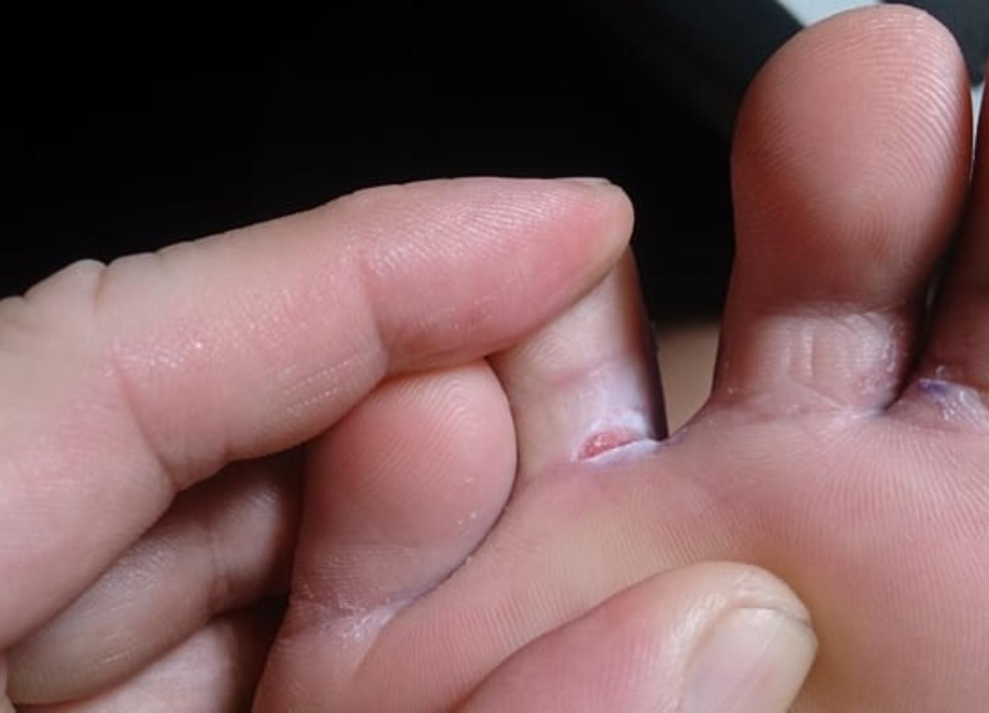 Τα-προβλήματα-υγείας-που-παρουσιάζονται-μετά-τις-καλοκαιρινές-διακοπές Τα-προβλήματα-υγείας-που-παρουσιάζονται-μετά-τις-καλοκαιρινές-διακοπές