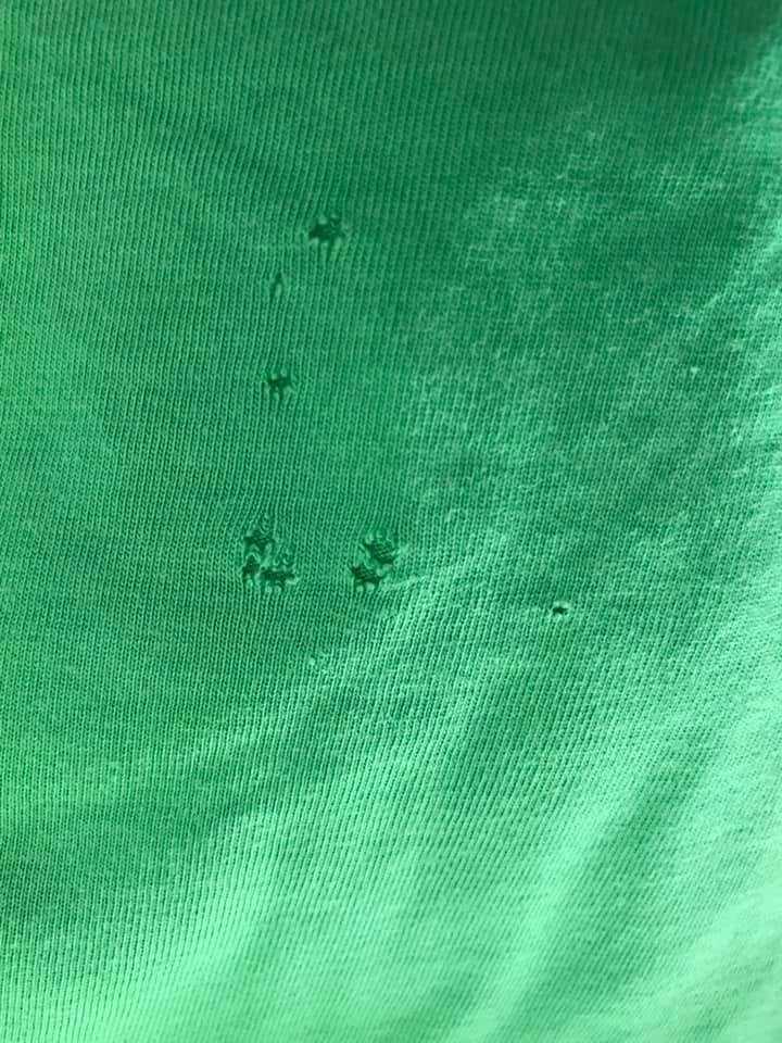 Σκόρος στην ντουλάπα: Πως να απαλλαγείτε πριν γεμίσουν τρύπες τα ρούχα σας