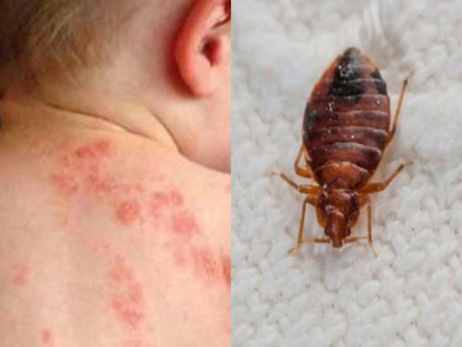 Το άκαρι της ψώρας : Επικίνδυνα συμπτώματα και τρόποι μετάδοσης στον άνθρωπο-Δείτε πως θα το εξολοθρεύσετε αποτελεσματικά