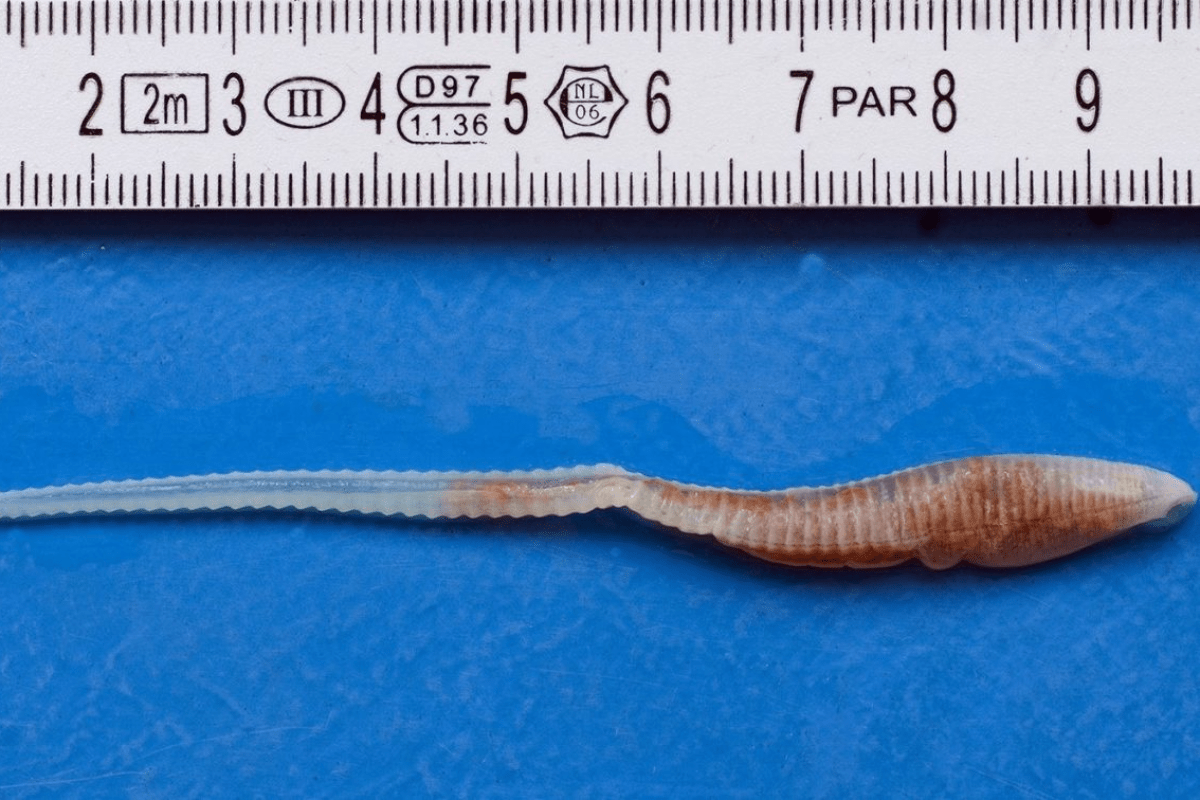 Συναγερμός για την ασθένεια σκουληκιών που ρουφούν το αίμα