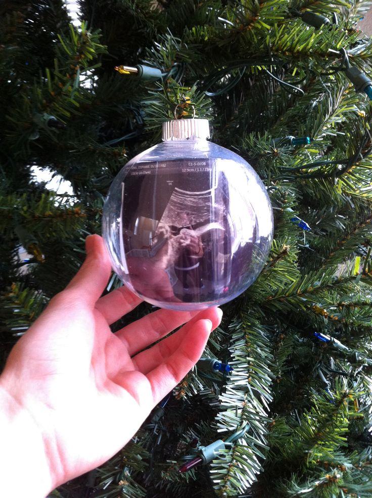 χριστουγεννιάτικες μπάλες-με-τον-υπέρηχο-των-παιδιών-ιδέες- χριστουγεννιάτικες μπάλες-με-τον-υπέρηχο-των-παιδιών-ιδέες-