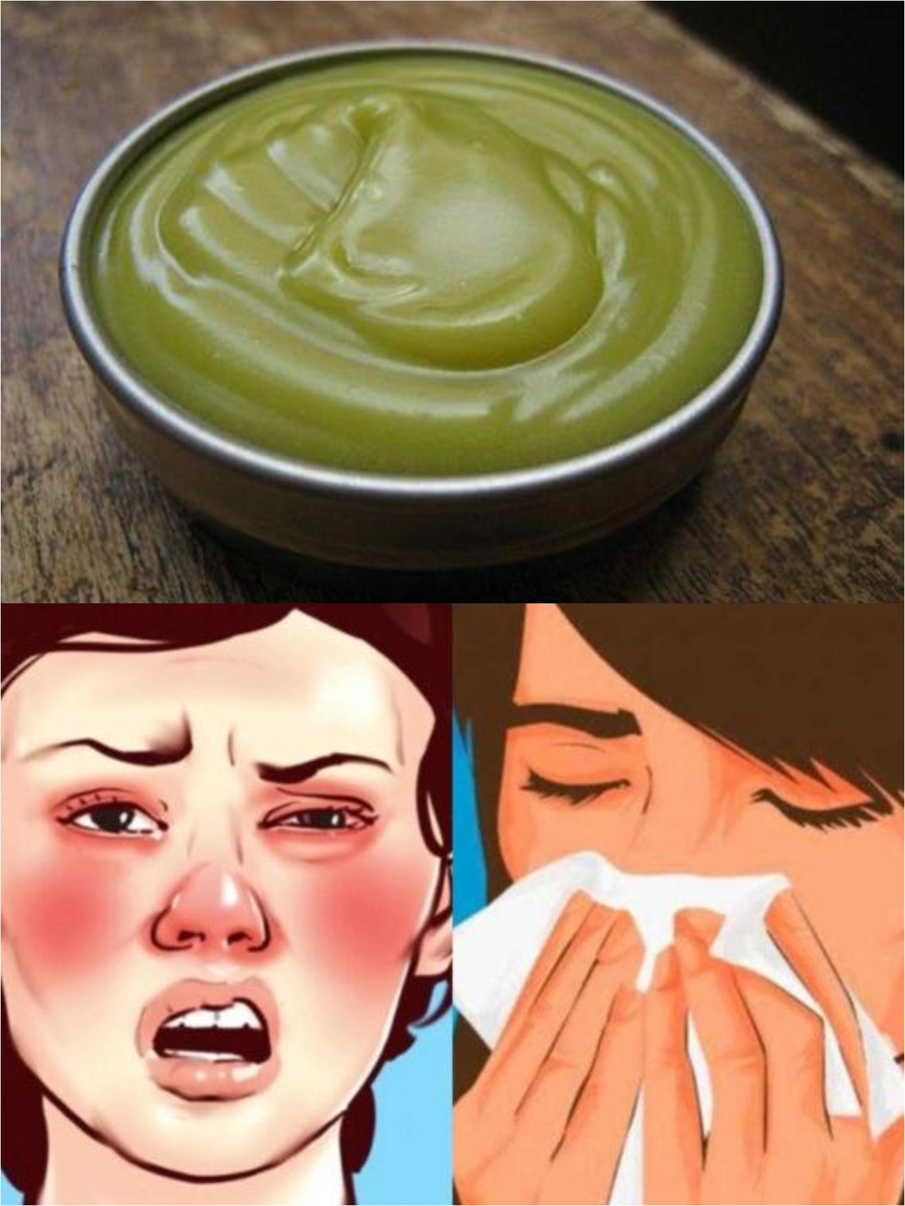 Σπιτική αλοιφή για να ξεβουλώσει η μύτη με γρήγορα αποτελέσματα