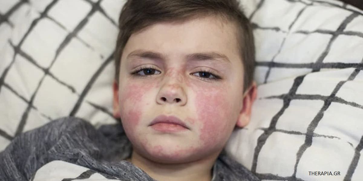 Στρεπτόκοκκος-τρόποι-μετάδοσης-και-ανησυχητικά-συμπτώματα Στρεπτόκοκκος-τρόποι-μετάδοσης-και-ανησυχητικά-συμπτώματα