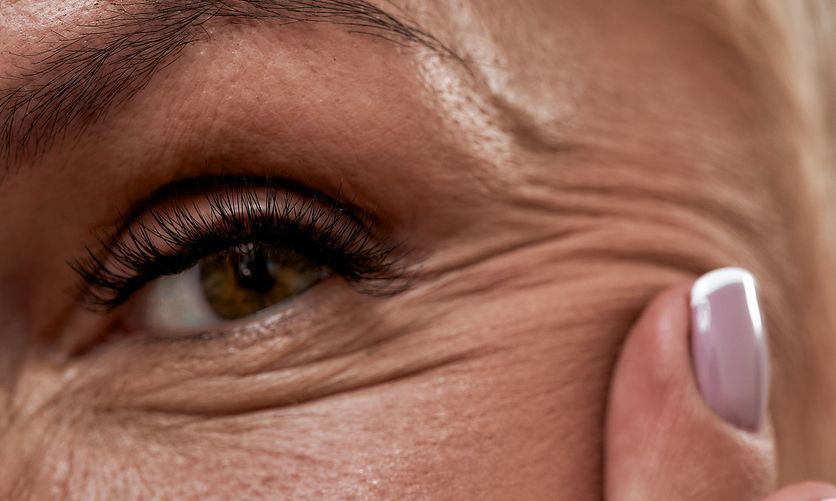 Καστορέλαιο-φυσικό-καλλυντικό-για-ακμή-ρυτίδες-και-φλεγμονές- Καστορέλαιο-φυσικό-καλλυντικό-για-ακμή-ρυτίδες-και-φλεγμονές-