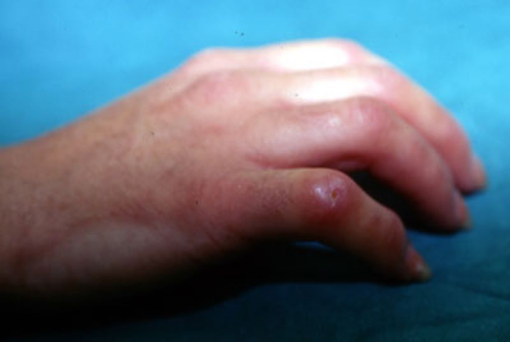 οι-λόγοι-που-η-βέρα-μπορεί-να-θέσει-σε-κίνδυνο-την-υγεία-μας- οι-λόγοι-που-η-βέρα-μπορεί-να-θέσει-σε-κίνδυνο-την-υγεία-μας-